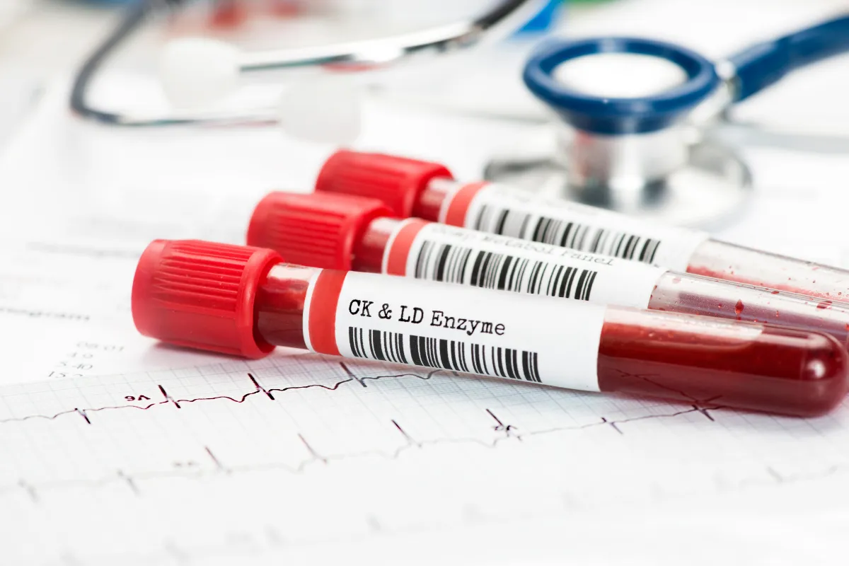 Lab Testing: Convenient And Accurate Results In The Louetta Area 1 Lab Technician Preparing A Blood Test.