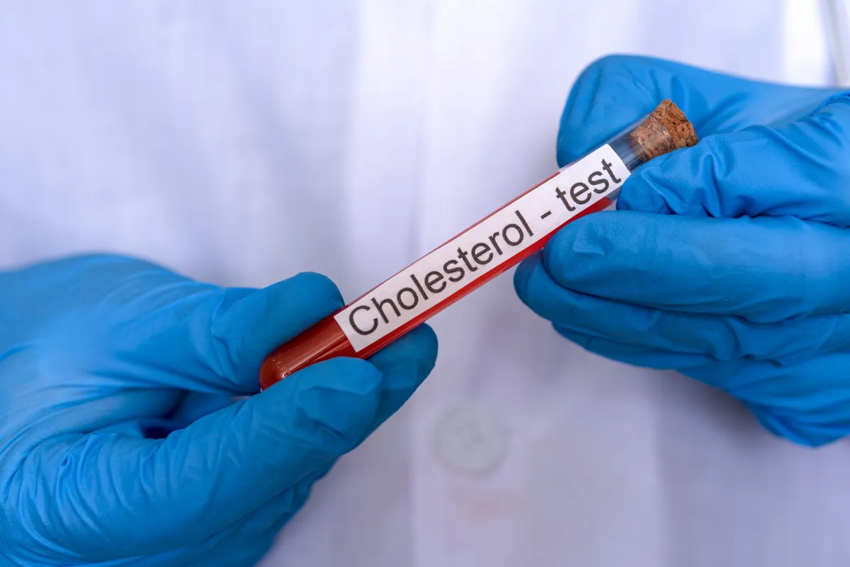Lab Testing: Convenient And Accurate Results In The Louetta Area 2 Close Up Of Blood Vials Being Tested.