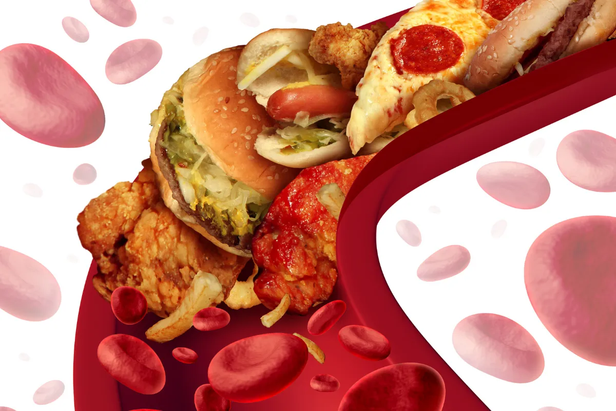 High Cholesterol Treatment Options: Finding The Right Fit In Spring 2 Dr. A Patient Care Consultation