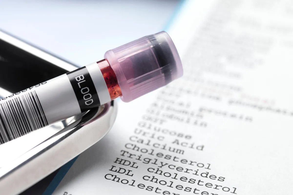 Lab Testing: Understanding Your Results In 77379 2 Doctor Explaining Lab Results To A Patient