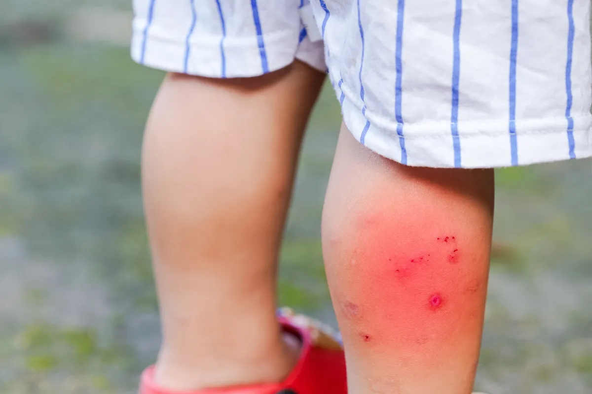 Doctor Examining A Patient'S Injured Arm